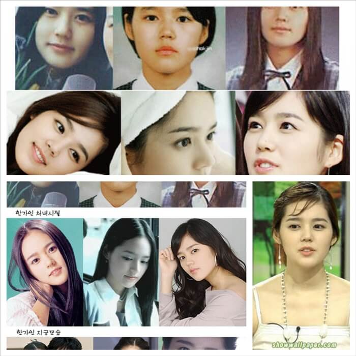 han ga in no plastic surgery