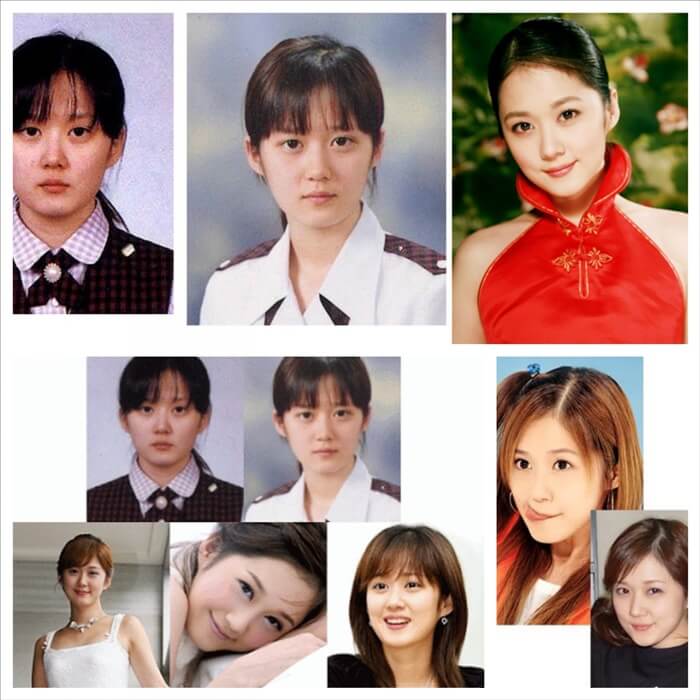 jang na ra no plastic surgery