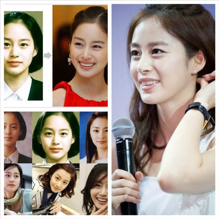 kim tae hee no plastic surgery